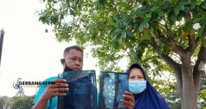 Bayi Berusia 42 Hari Alami Patah Tulang Usai Dapatkan Perawatan di RSUD M Sani